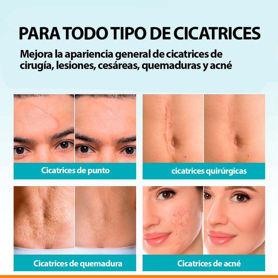 Spray De Cicatrices